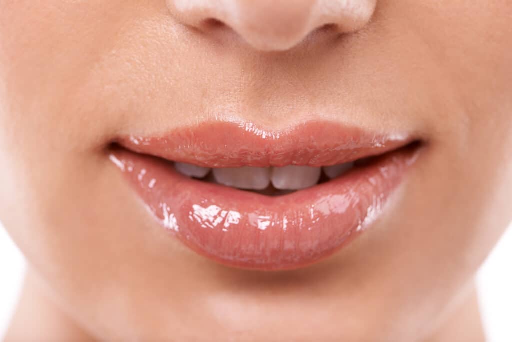 Thats A Perfect Smile 2024 03 15 06 16 05 Utc | Lip Augmentation,Hyaluronic Acid,What To Expect