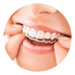 Invisalign_Icon