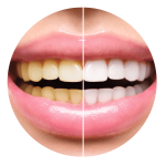 Teeth-Whitening_Icon